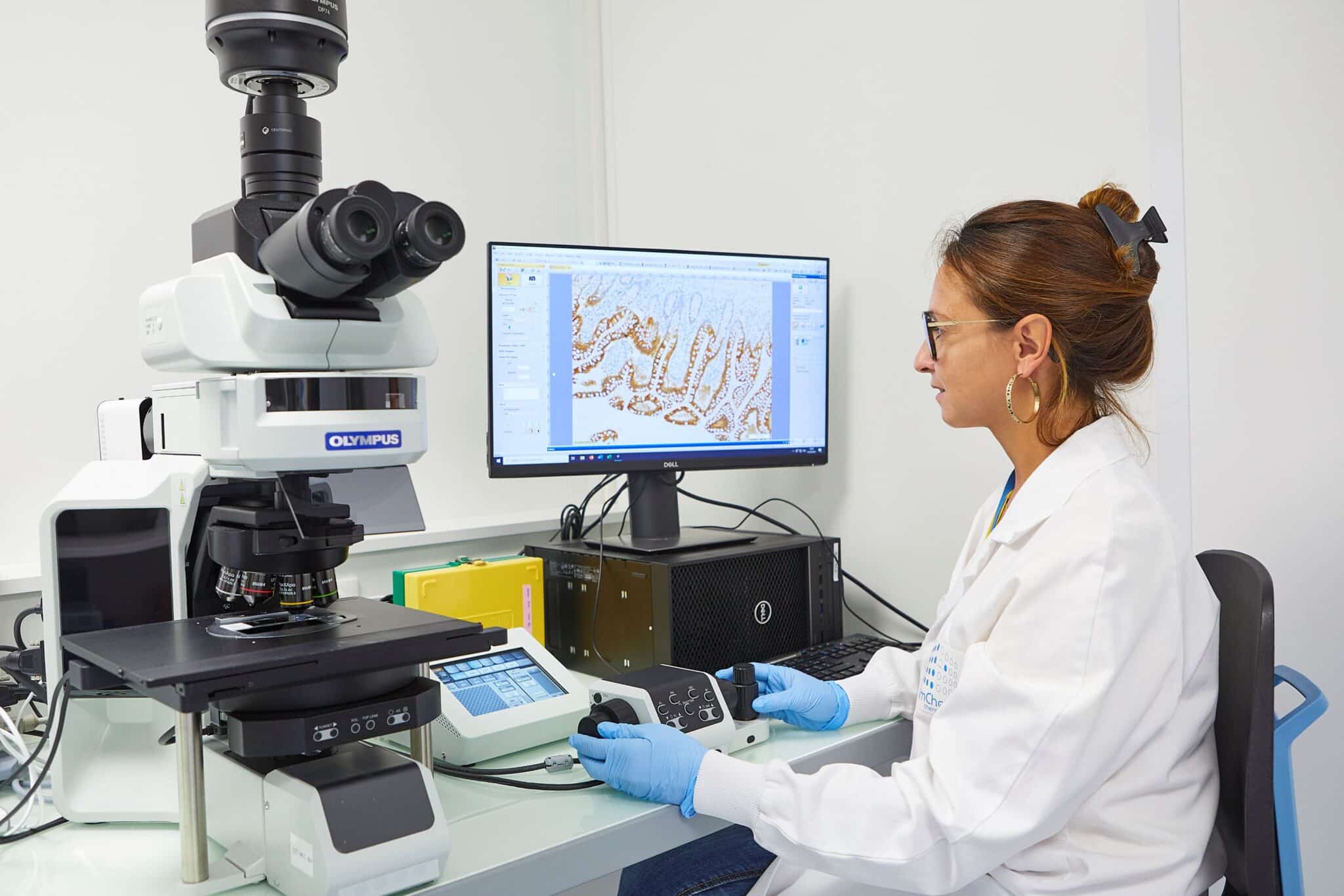 Ipsen rachète ImCheck
