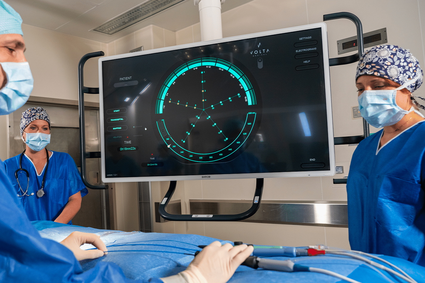 Volta Medical IA recherches cardiaques